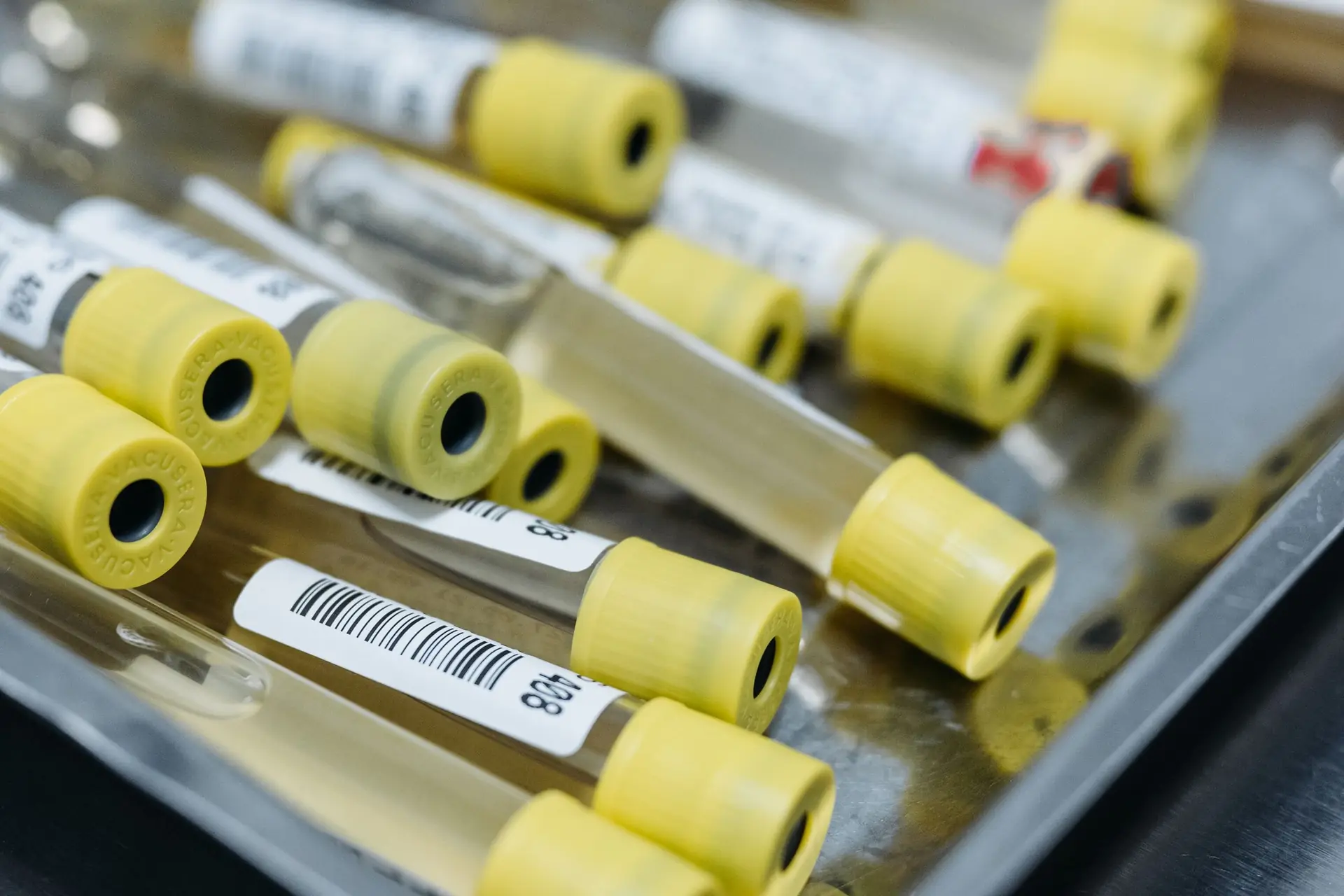 Labelled sample tubes with yellow caps on a laboratory tray